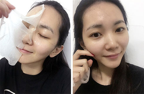 一个月解决痘痘方法,一个多月的痘痘怎么消