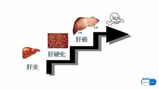 华蟾素治疗乙肝效果怎样,华蟾素胶囊对乙肝有用吗