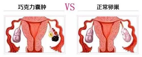 你的卵巢早衰了吗,你的卵巢