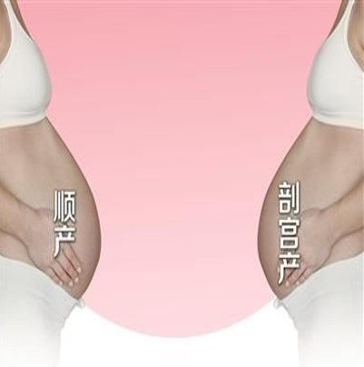 妊娠疤痕怀孕应注意什么,疤痕子宫怀孕怎样避免疤痕妊娠