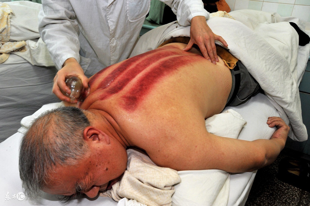 刮痧怎样才知道刮透了,刮痧要怎么才能刮透