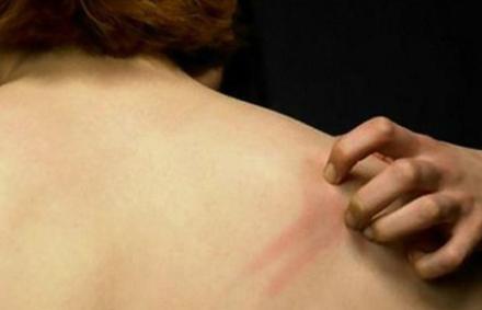 皮肤过敏湿疹瘙痒起疹子怎么解决,过敏性湿疹太痒怎么处理