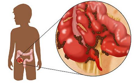 肠道衰老,哪些食物是肠道的清道夫
