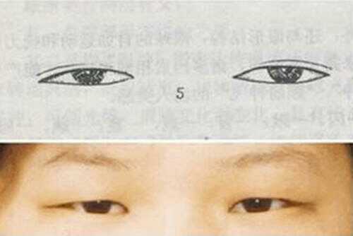 怎么知道你的眼型是哪种,99%的人不知道自己什么眼型
