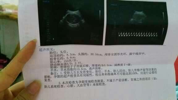 羊水早破怎么办!羊水破了多久会生?