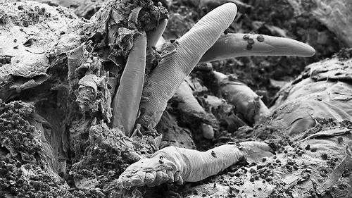 脸上的螨虫和被子里的螨虫,脸上的螨虫和被子上的螨虫一样吗