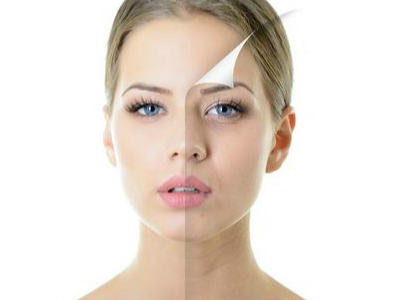 光子嫩肤的认识,光子嫩肤的介绍