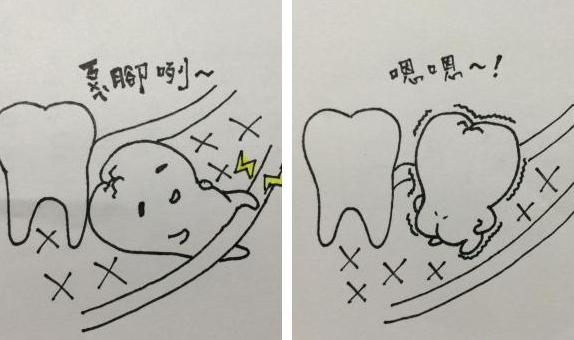 拔智齿后不能打喷嚏为什么,拔智齿后吐口水很疼怎么回事