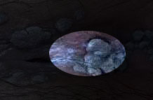 女性尖锐湿疣症状,尖锐性湿疣看什么科