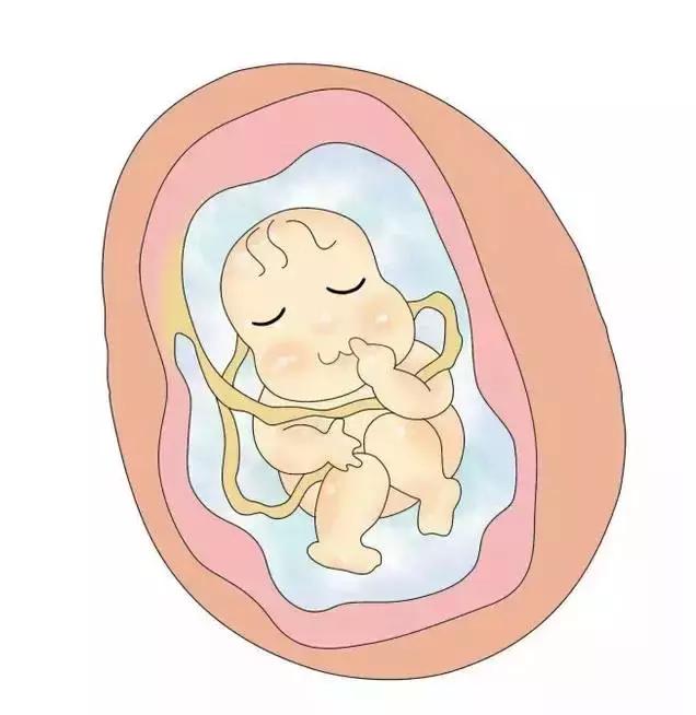 宝宝出生满脸胎记孕期注意,宝宝出生一定要戴露顶帽子吗