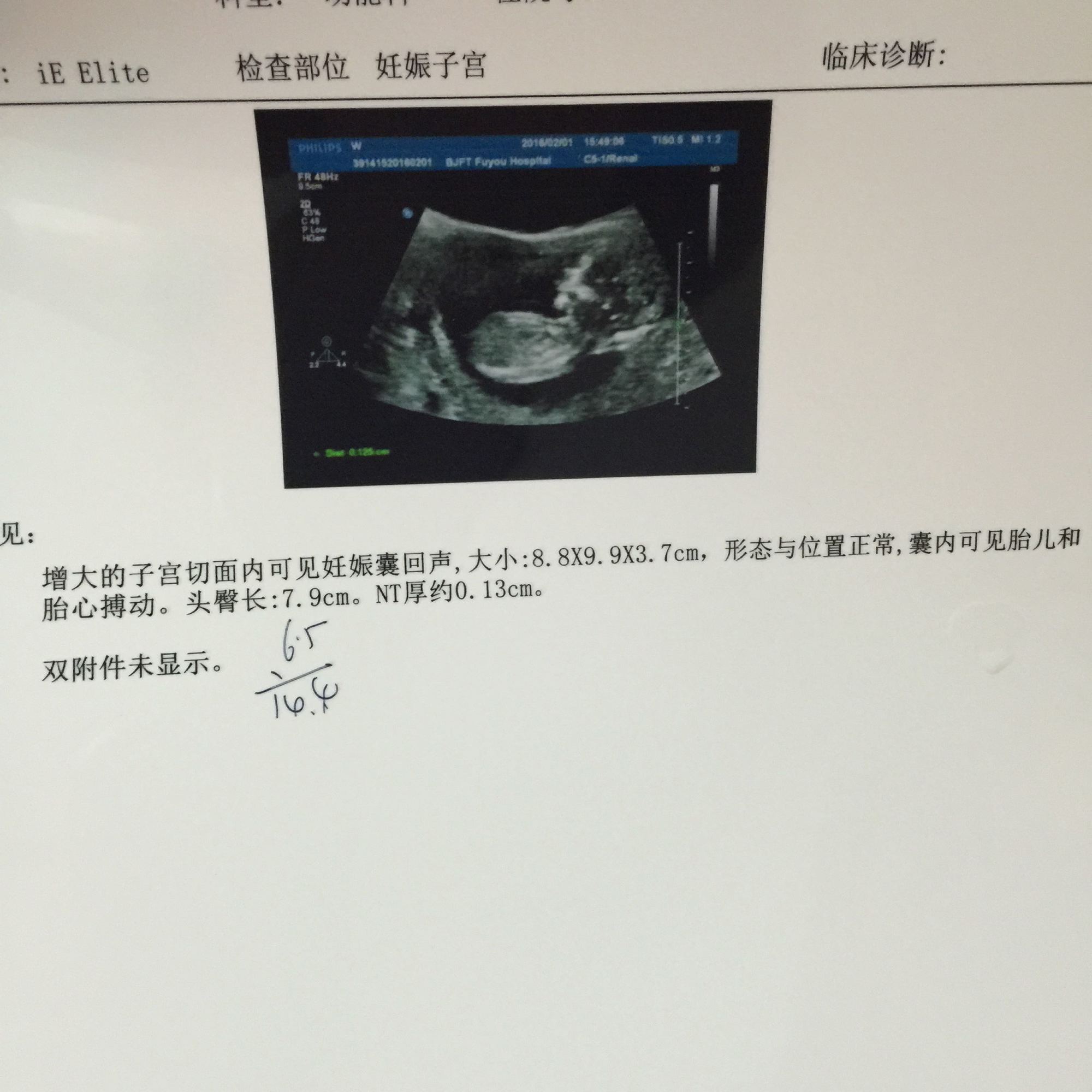 孕期出血保胎一般几天排干净淤血,一侧鼻子出血怎么快速止血小妙招