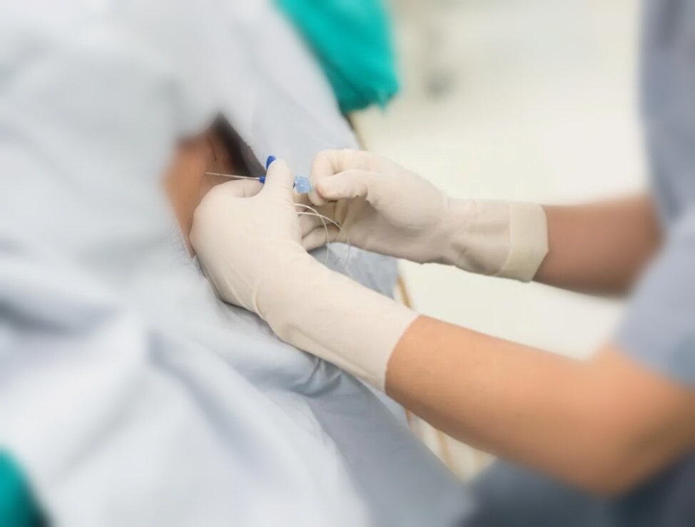 到底什么是无痛分娩？无痛分娩对宝宝有影响吗？