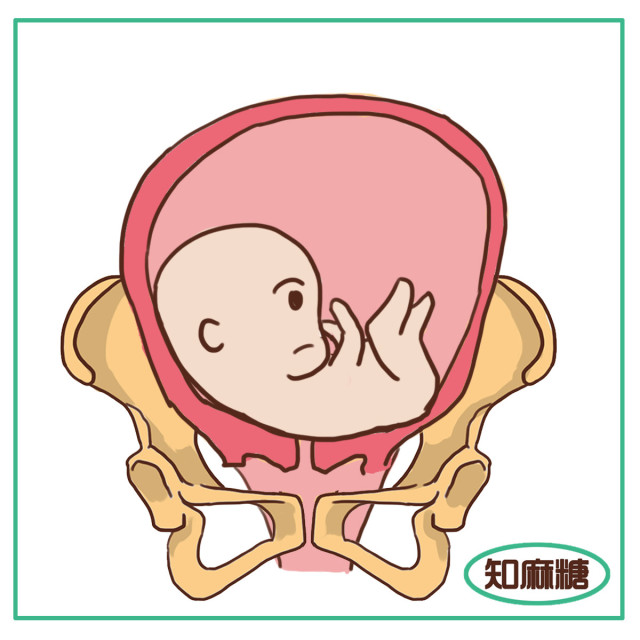 剖腹产必须知道的几件事,剖腹产一定要知道的事情