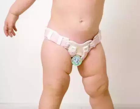 两岁男孩意外脑死亡父母捐献器官,两岁男童不幸离世妈妈含泪