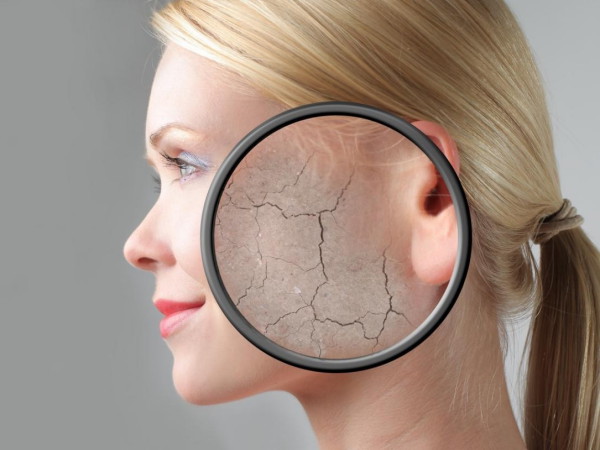 透过现象看本质图片素材,褐青色斑真实案例