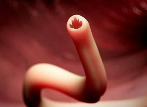 肠道衰老,哪些食物是肠道的清道夫