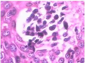 妇科痒一招就消,妇科里面痒怎么办