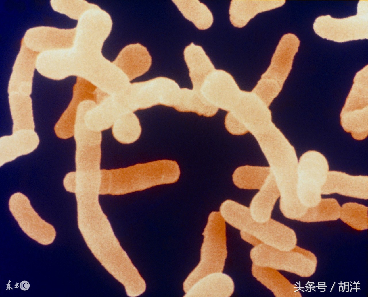 阿莫西林是好药你吃对了吗,阿莫西林到底是什么药