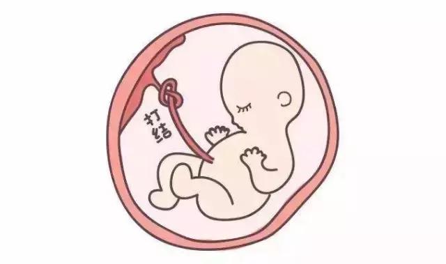 宝宝出生满脸胎记孕期注意,宝宝出生一定要戴露顶帽子吗