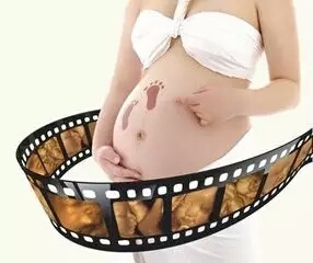 四维彩超——为腹中的胎儿“拍美照”