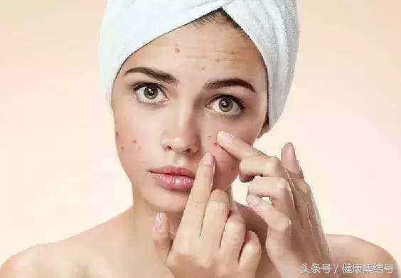 色斑的治疗方法,色斑分为哪几种怎么做可以淡化