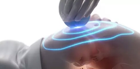 四维彩超——为腹中的胎儿“拍美照”