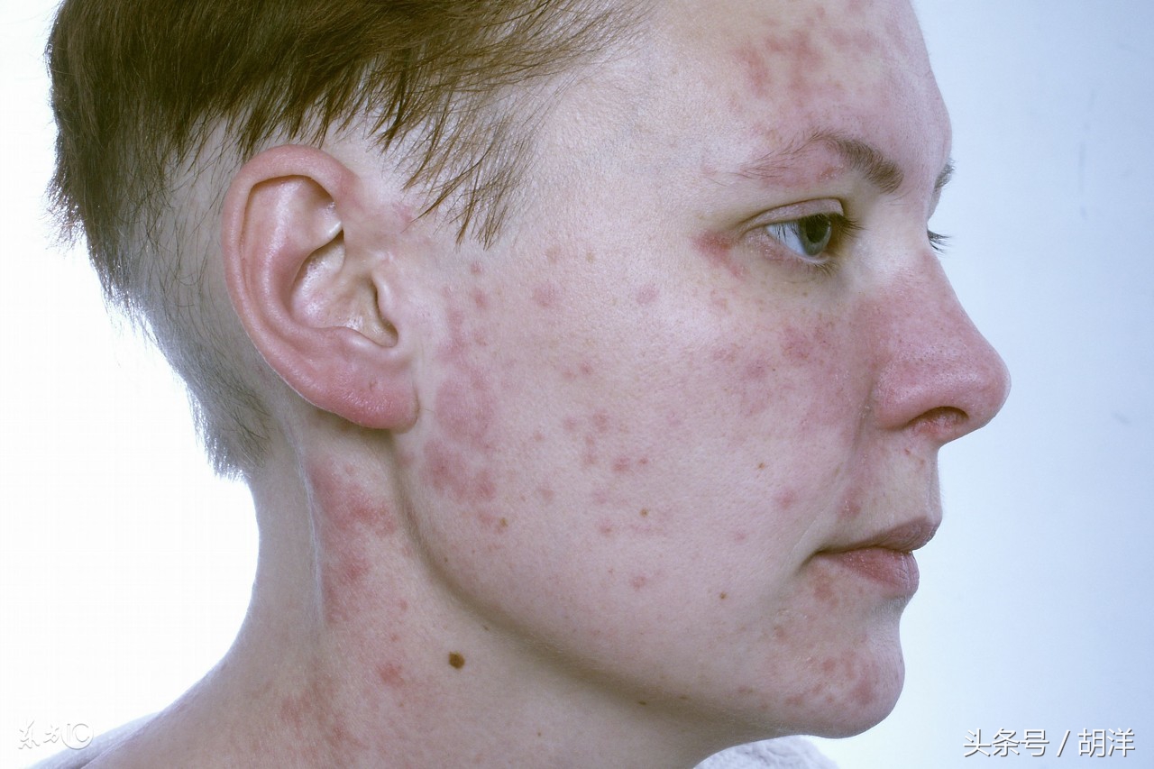 阿莫西林是好药你吃对了吗,阿莫西林到底是什么药