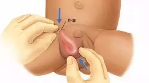 两岁男孩意外脑死亡父母捐献器官,两岁男童不幸离世妈妈含泪