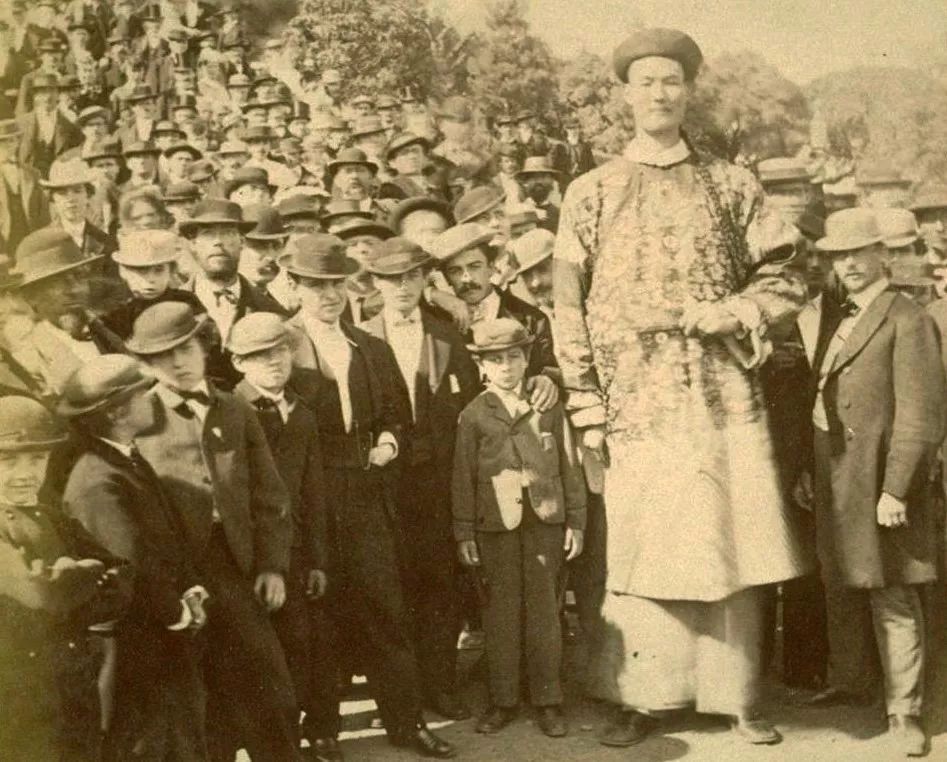 苏联发明断骨增高术,骨科医生神奇疗法