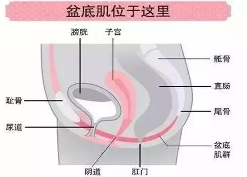 笑尿了怎么治疗,产后5年了还能做盆底肌修复吗