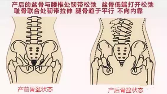 笑尿了怎么治疗,产后5年了还能做盆底肌修复吗