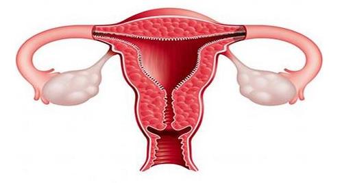 绝经后子宫内膜癌出血量大吗,绝经后出血一定是子宫内膜癌吗