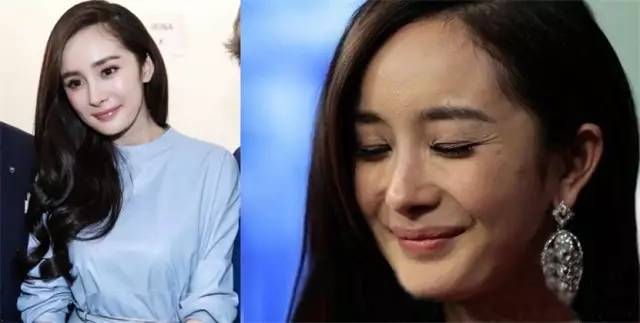 祛皱抗衰最好方法,皮肤抗衰祛皱的主战场是在哪一层