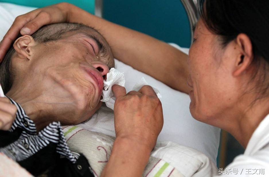 杜冷丁药品为什么是毒药,杜冷丁的功效与危害