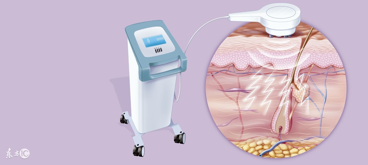 妊娠纹的中医辨证治疗方法,离子束激光治疗妊娠纹