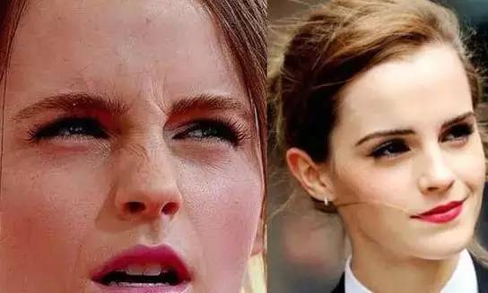 祛皱抗衰最好方法,皮肤抗衰祛皱的主战场是在哪一层