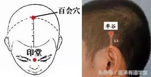 高血压针灸降压方法穴位图,高血压按哪个穴位能降压