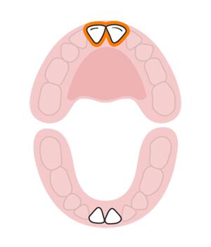 宝宝长牙顺序和换牙顺序一样吗,宝宝换牙有什么征兆