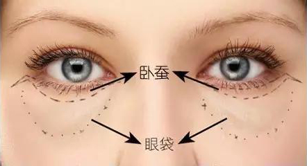 黑眼圈或眼袋很重?20几岁的年纪怎么办?