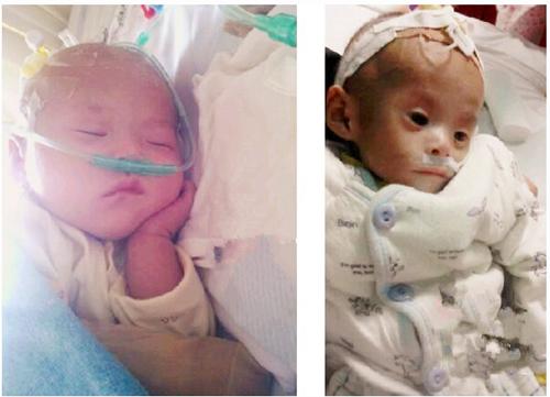 两个月宝宝全身都是湿疹怎么办,两个月宝宝浑身都长湿疹怎么办