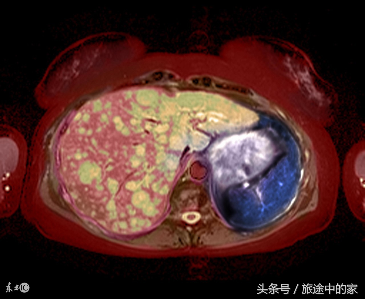 10种常见癌症早期症状知道能救命,这6种高发疾病要当心
