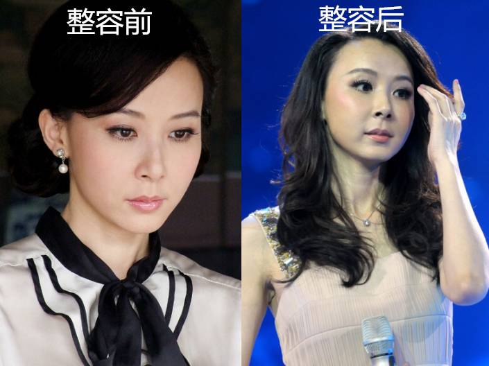 俄罗斯专家注射细菌抗衰老,抗衰老的细菌