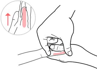 怎么判断宝宝咳嗽是肺热引起,宝宝肺热引起咳嗽怎么办