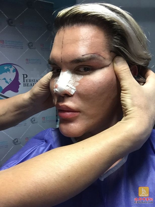 他花200万迪整成“芭比男友”因与护照不符在迪拜机场被拦截……