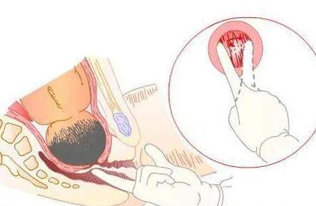 产前最让人崩溃的检查,产妇欲哭无泪,医生哭笑不得,简直了
