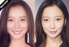 拯救大额头高发际线学王珞丹微风刘海超短发就搞定了