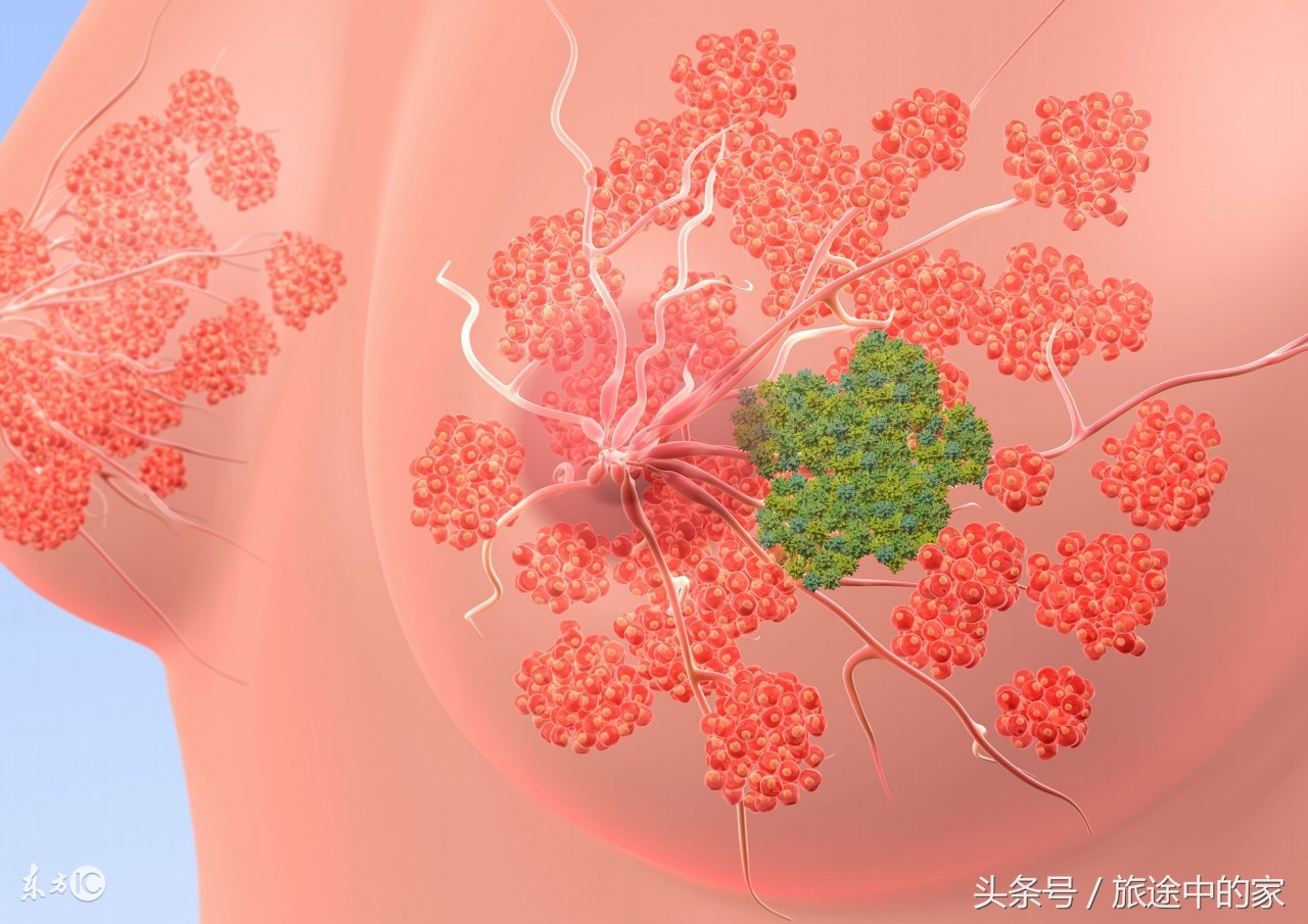 10种常见癌症早期症状知道能救命,这6种高发疾病要当心