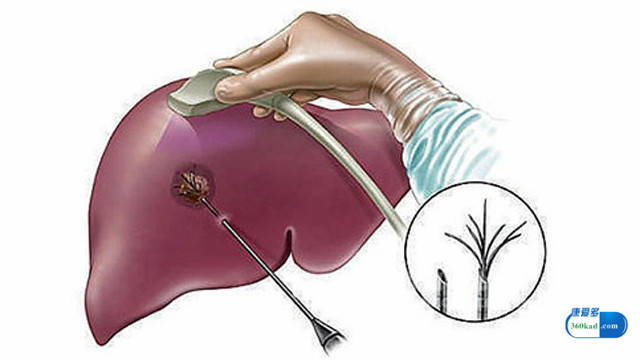 乙肝吃华蟾素有用吗,华蟾素对乙肝病毒作用