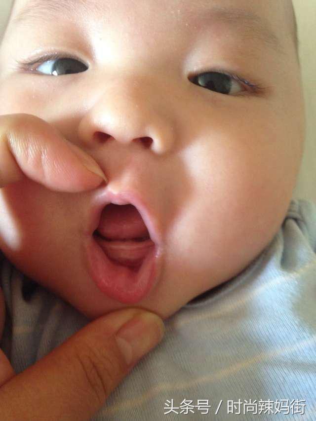 宝宝出牙期的不适感怎么缓解,怎样缓解出牙不适