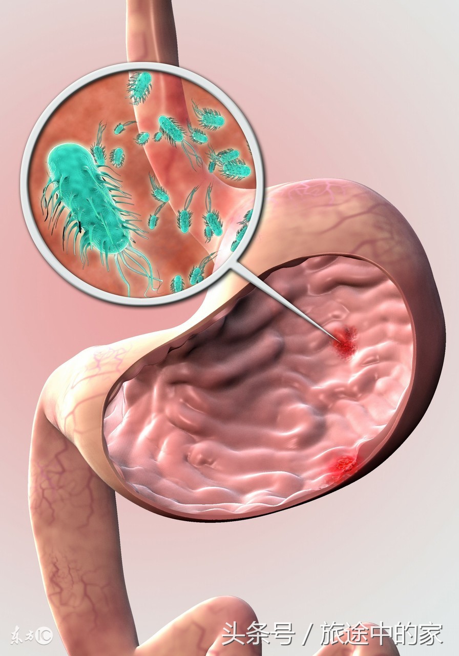 10种常见癌症早期症状知道能救命,这6种高发疾病要当心